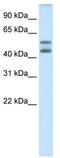 Interferon regulatory factor 5 antibody, TA342305, Origene, Western Blot image 