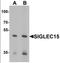 Sialic Acid Binding Ig Like Lectin 15 antibody, orb137304, Biorbyt, Western Blot image 