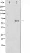 HsMAD2 antibody, TA325850, Origene, Western Blot image 