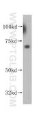 SAT antibody, 14708-1-AP, Proteintech Group, Western Blot image 