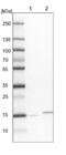 NADH:Ubiquinone Oxidoreductase Subunit A13 antibody, NBP1-90050, Novus Biologicals, Western Blot image 
