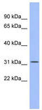 Spi-B Transcription Factor antibody, TA335784, Origene, Western Blot image 