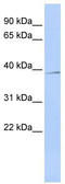 NAD-dependent ADP-ribosyltransferase sirtuin-4 antibody, TA330548, Origene, Western Blot image 