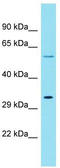 Keratin 79 antibody, TA337404, Origene, Western Blot image 