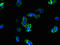 Reactive oxygen species modulator 1 antibody, orb356471, Biorbyt, Immunocytochemistry image 