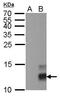 PPY antibody, GTX629070, GeneTex, Western Blot image 
