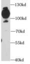 CD36 Molecule antibody, FNab01470, FineTest, Western Blot image 