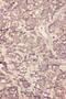Fibroblast Growth Factor 19 antibody, PA1476, Boster Biological Technology, Immunohistochemistry paraffin image 
