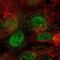 Cerebellar Degeneration Related Protein 1 antibody, NBP2-57758, Novus Biologicals, Immunocytochemistry image 
