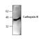 Cathepsin K antibody, AP00259PU-N, Origene, Western Blot image 