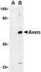 Cell death regulator Aven antibody, NBP1-76764, Novus Biologicals, Western Blot image 
