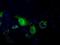 Pantothenate Kinase 2 antibody, NBP2-02677, Novus Biologicals, Immunofluorescence image 