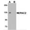 Rap Guanine Nucleotide Exchange Factor 4 antibody, MBS150704, MyBioSource, Western Blot image 