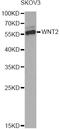 Wnt Family Member 2 antibody, STJ28427, St John