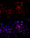 Cytochrome P450 Family 2 Subfamily J Member 2 antibody, 15-846, ProSci, Immunofluorescence image 