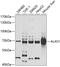 5-aminolevulinate synthase, nonspecific, mitochondrial antibody, GTX66478, GeneTex, Western Blot image 