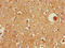 Zinc Finger FYVE-Type Containing 26 antibody, orb400296, Biorbyt, Immunohistochemistry paraffin image 