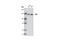 Zinc Finger Protein X-Linked antibody, 5419S, Cell Signaling Technology, Western Blot image 