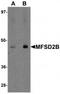 Major Facilitator Superfamily Domain Containing 2B antibody, TA320187, Origene, Western Blot image 