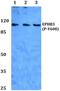 Ephrin type-B receptor 3 antibody, PA5-37348, Invitrogen Antibodies, Western Blot image 