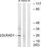 Low Density Lipoprotein Receptor Class A Domain Containing 1 antibody, TA316402, Origene, Western Blot image 