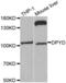 Dihydropyrimidine Dehydrogenase antibody, abx001364, Abbexa, Western Blot image 