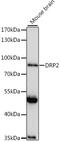 Dystrophin Related Protein 2 antibody, 16-166, ProSci, Western Blot image 