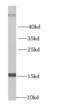 Nucleoside diphosphate kinase B antibody, FNab05763, FineTest, Western Blot image 
