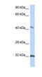 Connexin-45 antibody, NBP1-59282, Novus Biologicals, Western Blot image 