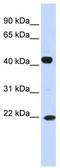 SSX Family Member 4B antibody, TA339114, Origene, Western Blot image 