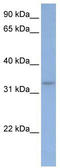 Deleted in azoospermia-like antibody, TA345773, Origene, Western Blot image 