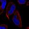 Microtubule-associated proteins 1A/1B light chain 3C antibody, HPA072670, Atlas Antibodies, Immunofluorescence image 