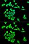 Growth Factor Receptor Bound Protein 2 antibody, GTX32632, GeneTex, Immunocytochemistry image 