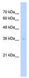 TruB Pseudouridine Synthase Family Member 2 antibody, TA346620, Origene, Western Blot image 