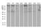 Rho GTPase Activating Protein 5 antibody, M05701, Boster Biological Technology, Western Blot image 