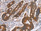 PDZ and LIM domain protein 1 antibody, CSB-PA184980, Cusabio, Immunohistochemistry paraffin image 