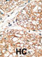 BCL2 Family Apoptosis Regulator BOK antibody, abx027215, Abbexa, Immunohistochemistry paraffin image 