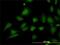 Stromal interaction molecule 1 antibody, H00006786-M01, Novus Biologicals, Immunocytochemistry image 
