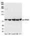 Vacuolar protein sorting-associated protein 35 antibody, A304-727A, Bethyl Labs, Western Blot image 