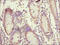 ST2 antibody, CSB-PA07019A0Rb, Cusabio, Immunohistochemistry paraffin image 