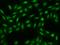 SPATA31 Subfamily E Member 1 antibody, 205337-T02, Sino Biological, Immunohistochemistry paraffin image 