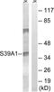 Zinc transporter ZIP1 antibody, GTX87436, GeneTex, Western Blot image 