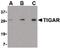 TP53 Induced Glycolysis Regulatory Phosphatase antibody, PA5-20346, Invitrogen Antibodies, Western Blot image 