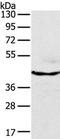 Mitogen-Activated Protein Kinase 8 antibody, TA324296, Origene, Western Blot image 