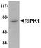 Receptor-interacting serine/threonine-protein kinase 1 antibody, NBP1-77077, Novus Biologicals, Western Blot image 