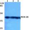 Melanin Concentrating Hormone Receptor 2 antibody, GTX66851, GeneTex, Western Blot image 