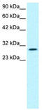 Jumonji Domain Containing 8 antibody, TA329722, Origene, Western Blot image 