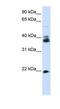 Synaptophysin antibody, NBP1-59660, Novus Biologicals, Enzyme Linked Immunosorbent Assay image 