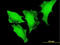 Forkhead Box O3 antibody, LS-B6085, Lifespan Biosciences, Immunofluorescence image 