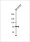 Zinc Finger Protein 219 antibody, GTX82519, GeneTex, Western Blot image 